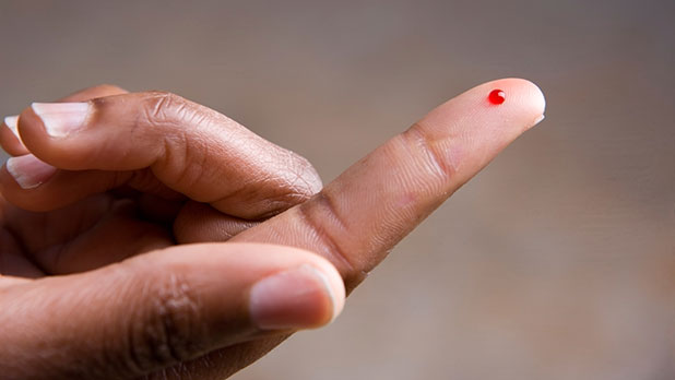 Finger prick blood