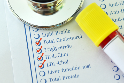 Test ordering LDL cholesterol