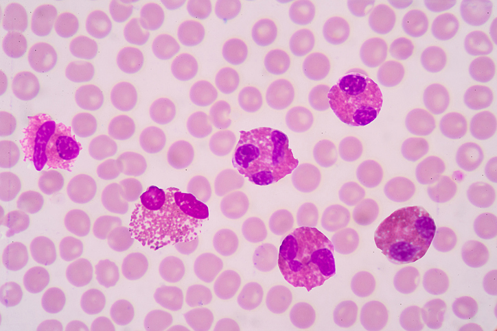 blood with eosinophils