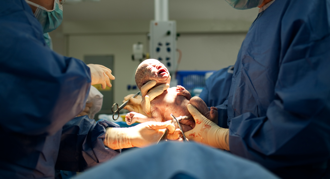 doctors holding baby just born by caesarian section