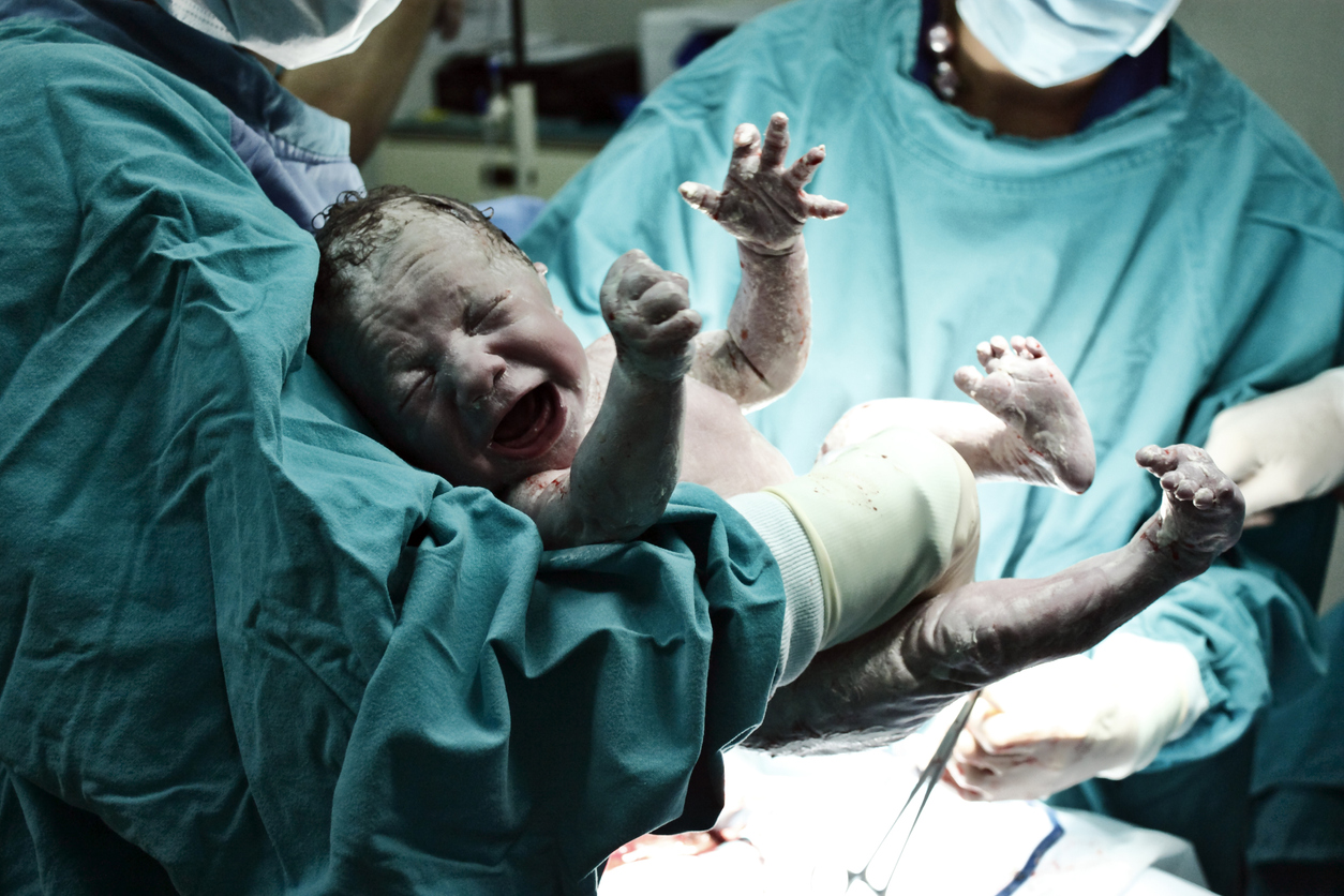 Doctors delivering a baby by caesarian