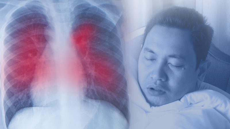 Patient and chest X-ray signifying coronavirus