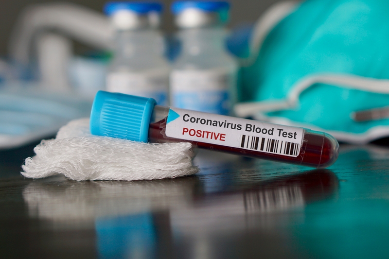 Blood test coronavirus
