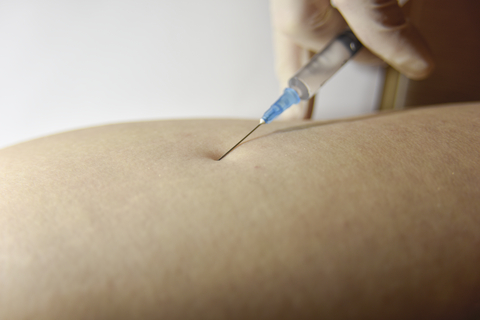 intramuscular injection