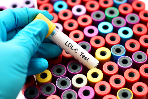 LDL-C test