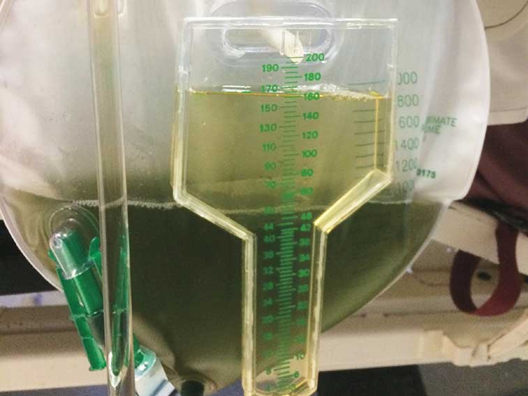 Green urine