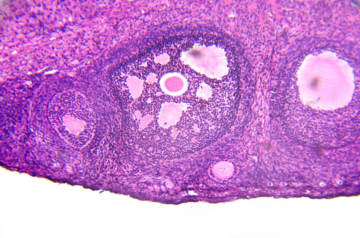 Histology of ovary with developing follicles