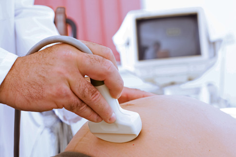 Pregnancy ultrasound
