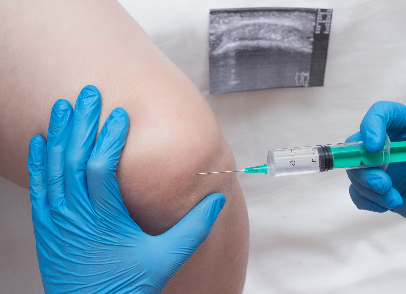 steroid knee injection
