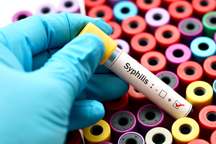 Syphilis pathology